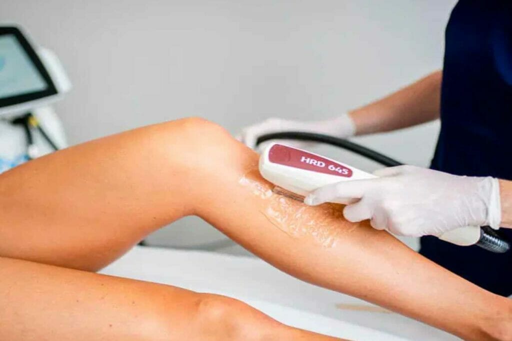 laser-hair-removal-orlando